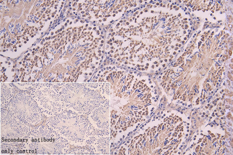 Immunohistochemistry of paraffin-embedded human testis tissue using DNALI1 Antibody at dilution of 1:100Rabbit anti-Human DNALI1 Polyclonal Antibody