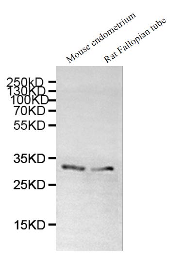 Western blot  | All lanes: DNALI1 antibody at 1µg/ml  | Lane 1: Mouse gonadal tissue  | Lane 2: Mouse lung tissue  | Secondary  | Goat polyclonal to rabbit IgG at 1/10000 dilution  | Predicted band size: 30, 16 kDa  | Observed band size: 30 kDaRabbit anti-Human DNALI1 Polyclonal Antibody