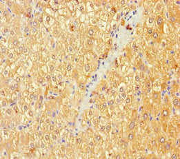 Immunohistochemistry of paraffin-embedded human liver tissue using B4GALT3 Antibody at dilution of 1:100