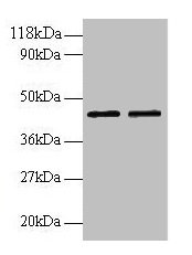 Western blot  | All lanes: B4GALT3 antibody at 2µg/ml  | Lane 1: EC109 whole cell lysate  | Lane 2: 293T whole cell lysate  | Secondary  | Goat polyclonal to rabbit IgG at 1/15000 dilution  | Predicted band size: 44, 16 kDa  | Observed band size: 44 kDa