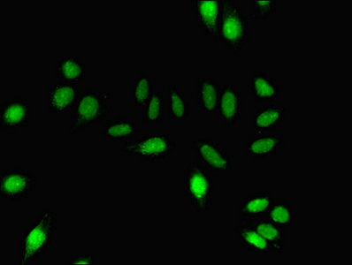 Immunofluorescent analysis of A549 cells using DNM1 Antibody at dilution of 1:100 and Alexa Fluor 488-congugated AffiniPure Goat Anti-Rabbit IgG(H+L)Rabbit anti-Human DNM1 Polyclonal Antibody