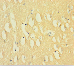 Immunohistochemistry of paraffin-embedded human brain tissue using DNM1 Antibody at dilution of 1:100Rabbit anti-Human DNM1 Polyclonal Antibody