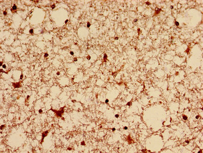 Immunohistochemistry analysis of human brain tissue using DNM1L Antibody at dilution of 1:100Rabbit anti-Human DNM1L Polyclonal Antibody