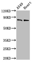Western Blot  | Positive WB detected in: A549 whole cell lysate, Mouse heart tissue  | All lanes: DNM1L antibody at 0.5µg/ml  | Secondary  | Goat polyclonal to rabbit IgG at 1/50000 dilution  | Predicted band size: 82, 81, 80, 79, 84, 61, 83 kDa  | Observed band size: 82 kDaRabbit anti-Human DNM1L Polyclonal Antibody