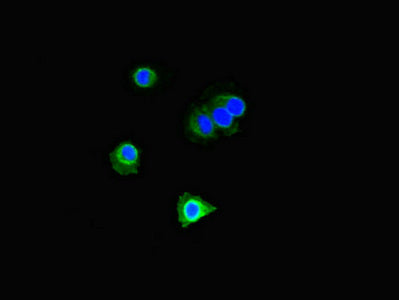 Immunofluorescent analysis of Hela cells using DOK2 Antibody at dilution of 1:100 and Alexa Fluor 488-congugated AffiniPure Goat Anti-Rabbit IgG(H+L)Rabbit anti-Human DOK2 Polyclonal Antibody