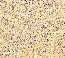 Immunohistochemistry of paraffin-embedded human spleen tissue using the antibody at dilution of 1:100Rabbit anti-Human DOK2 Polyclonal Antibody