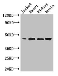 Western Blot | Positive WB detected in: Jurkat whole cell lysate, Mouse heart tissue, Mouse kidney tissue, Mouse brain tissue | All lanes: DOK2 antibody at 3.4μg/ml | Secondary | Goat polyclonal to rabbit IgG at 1/50000 dilution | Predicted band size: 46 kDa | Observed band size: 46 kDaRabbit anti-Human DOK2 Polyclonal Antibody