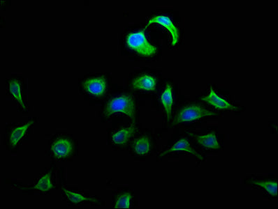 Immunofluorescence staining of A549 cells with the antibody at 1:133, counter-stained with DAPI. The cells were fixed in 4% formaldehyde, permeabilized using 0.2% Triton X-100 and blocked in 10% normal Goat Serum. The cells were then incubated with the antibody overnight at 4°C. The secondary antibody was Alexa Fluor 488-congugated AffiniPure Goat Anti-Rabbit IgG(H+L).Rabbit anti-Human DOK5 Polyclonal Antibody