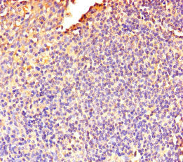 Immunohistochemistry of paraffin-embedded human tonsil tissue using DOK5 Antibody at dilution of 1:100Rabbit anti-Human DOK5 Polyclonal Antibody