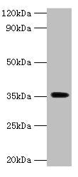 Western blot  | All lanes: DOK5 antibody at 2µg/ml + Mouse kidney tissue  | Secondary  | Goat polyclonal to rabbit IgG at 1/15000 dilution  | Predicted band size: 36, 23 kDa  | Observed band size: 36 kDaRabbit anti-Human DOK5 Polyclonal Antibody
