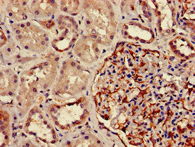 Immunohistochemistry of paraffin-embedded human kidney tissue using DPM1 Antibody at dilution of 1:100Rabbit anti-Human DPM1 Polyclonal Antibody