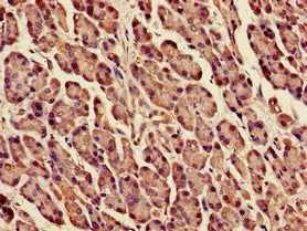 Immunohistochemistry of paraffin-embedded human pancreatic tissue using DPM1 Antibody at dilution of 1:100Rabbit anti-Human DPM1 Polyclonal Antibody