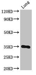 Western Blot | Positive WB detected in: Mouse lung tissue | All lanes: DPM1 antibody at 3μg/ml | Secondary | Goat polyclonal to rabbit IgG at 1/50000 dilution | Predicted band size: 30 kDa | Observed band size: 30 kDaRabbit anti-Human DPM1 Polyclonal Antibody