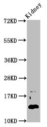 Western Blot | Positive WB detected in: Mouse kidney tissue | All lanes: DPPA5 antibody at 4.6μg/ml | Secondary | Goat polyclonal to rabbit IgG at 1/50000 dilution | Predicted band size: 14 kDa | Observed band size: 14 kDaRabbit anti-Human DPPA5 Polyclonal Antibody