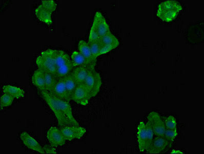 Immunofluorescent analysis of HepG2 cells using DPYS Antibody at dilution of 1:100 and Alexa Fluor 488-congugated AffiniPure Goat Anti-Rabbit IgG(H+L)Rabbit anti-Human DPYS Polyclonal Antibody