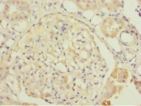 Immunohistochemistry of paraffin-embedded human kidney tissue using DPYS Antibody at dilution of 1:100Rabbit anti-Human DPYS Polyclonal Antibody