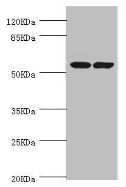 Western blot | All lanes: DPYS antibody at 1.1μg/ml | Lane 1: Mouse liver tissue | Lane 2: Mouse kidney tissue | Secondary | Goat polyclonal to rabbit IgG at 1/10000 dilution | Predicted band size: 57 kDa | Observed band size: 57 kDaRabbit anti-Human DPYS Polyclonal Antibody