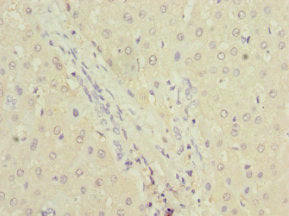 Immunohistochemistry of paraffin-embedded human liver tissue using DPYS Antibody at dilution of 1:100