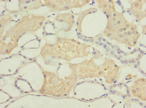 Immunohistochemistry of paraffin-embedded human kidney tissue using DPYS Antibody at dilution of 1:100