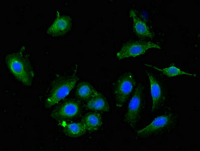 Immunofluorescent analysis of A549 cells using DPYSL4 Antibody at dilution of 1:100 and Alexa Fluor 488-congugated AffiniPure Goat Anti-Rabbit IgG(H+L)Rabbit anti-Human DPYSL4 Polyclonal Antibody