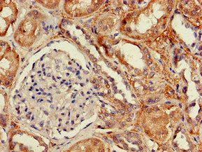 Immunohistochemistry of paraffin-embedded human kidney tissue using DPYSL4 Antibody at dilution of 1:100Rabbit anti-Human DPYSL4 Polyclonal Antibody