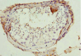 Immunohistochemistry of paraffin-embedded human testis tissue using DR1 Antibody at dilution of 1:100Rabbit anti-Human DR1 Polyclonal Antibody