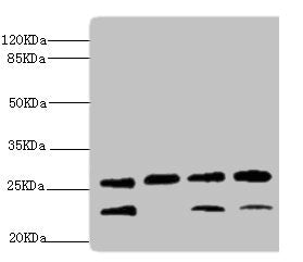 Western blot | All lanes: DR1 antibody at 2.32μg/ml | Lane 1: Rat gonad tissue | Lane 2: PC-3 whole cell lysate | Lane 3: Hela whole cell lysate | Lane 4: 293T whole cell lysate | Secondary | Goat polyclonal to rabbit IgG at 1/10000 dilution | Predicted band size: 19 kDa | Observed band size: 23, 26 kDaRabbit anti-Human DR1 Polyclonal Antibody