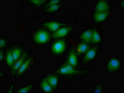 Immunofluorescent analysis of A549 cells using DRD1 Antibody at dilution of 1:100 and Alexa Fluor 488-congugated AffiniPure Goat Anti-Rabbit IgG(H+L)Rabbit anti-Human DRD1 Polyclonal Antibody