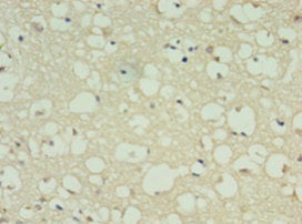 Immunohistochemistry of paraffin-embedded human brain tissue using DRD5 Antibody at dilution of 1:100Rabbit anti-Human DRD5 Polyclonal Antibody