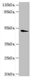 Western blot  | All lanes: DRD5 antibody at 2µg/ml + Mouse brain tissue  | Secondary  | Goat polyclonal to rabbit IgG at 1/10000 dilution  | Predicted band size: 53 kDa  | Observed band size: 53 kDaRabbit anti-Human DRD5 Polyclonal Antibody