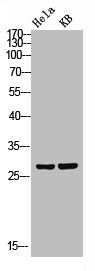 Western blot analysis of Hela KB lysis using Claudin-3 antibody.Rabbit anti-Human CLDN3 Polyclonal Antibody