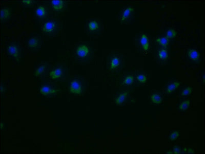 Immunofluorescence staining of Jurkat cells with DUOX2 Antibody at 1:50, counter-stained with DAPI. The cells were fixed in 4% formaldehyde and blocked in 10% normal Goat Serum. The cells were incubated with the antibody overnight at 4°C. Nuclear DNA was labeled in blue with DAPI. The secondary antibody was FITC-conjugated AffiniPure Goat Anti-Rabbit IgG (H+L).Rabbit anti-Human DUOX2 Polyclonal Antibody