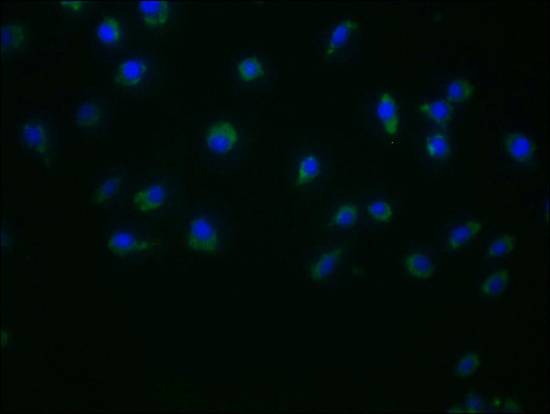 Immunofluorescence staining of Jurkat cells with DUOX2 Antibody at 1:50, counter-stained with DAPI. The cells were fixed in 4% formaldehyde and blocked in 10% normal Goat Serum. The cells were incubated with the antibody overnight at 4°C. Nuclear DNA was labeled in blue with DAPI. The secondary antibody was FITC-conjugated AffiniPure Goat Anti-Rabbit IgG (H+L).Rabbit anti-Human DUOX2 Polyclonal Antibody