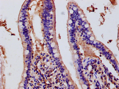 Immunohistochemistry of paraffin-embedded human small intestine tissue using the antibody at dilution of 1:50Rabbit anti-Human DUOX2 Polyclonal Antibody