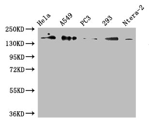 Positive WB detected in: Hela whole cell lysate, A549 whole cell lysate, PC3 whole cell lysate, 293 whole cell lysate, Ntera-2 whole cell lysate All lanes: DUOX2 antibody at 1:500 Secondary Goat polyclonal to rabbit IgG at 1/50000 dilution Predicted band size: 176 kDa Observed band size: 176 kDaRabbit anti-Human DUOX2 Polyclonal Antibody