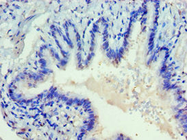 Immunohistochemistry of paraffin-embedded human lung tissue using the antibody at dilution of 1:100Rabbit anti-Human DVL2 Polyclonal Antibody