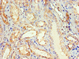 Immunohistochemistry of paraffin-embedded human kidney tissue using DVL2 Antibody at dilution of 1:100Rabbit anti-Human DVL2 Polyclonal Antibody