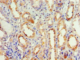 Immunohistochemistry of paraffin-embedded human kidney tissue using DVL2 Antibody at dilution of 1:100Rabbit anti-Human DVL2 Polyclonal Antibody