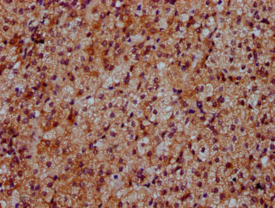 IHC image of DYM Antibody diluted at 1:500 and staining in paraffin-embedded human adrenal gland tissue performed on a Leica BondTM system. After dewaxing and hydration, antigen retrieval was mediated by high pressure in a citrate buffer (pH 6.0). Section was blocked with 10% normal goat serum 30min at RT. Then primary antibody (1% BSA) was incubated at 4°C overnight. The primary is detected by a biotinylated secondary antibody and visualized using an HRP conjugated SP system.Rabbit anti-Human DYM Polyclonal Antibody