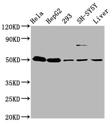 Western Blot  | Positive WB detected in: Hela whole cell lysate, HepG2 whole cell lysate, 293 whole cell lysate, SH-SY5Y whole cell lysate, Mouse liver tissue  | All lanes: DYM antibody at 3.7µg/ml  | Secondary  | Goat polyclonal to rabbit IgG at 1/50000 dilution  | Predicted band size: 76, 55 kDa  | Observed band size: 55 kDaRabbit anti-Human DYM Polyclonal Antibody