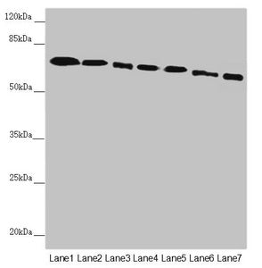 Western blot  | All lanes: DYNC1I1 antibody at 2.52µg/ml  | Lane 1: Mouse brain tissue  | Lane 2: Mouse gonadal tissue  | Lane 3: K562 whole cell lysate  | Lane 4: HL60 whole cell lysate  | Lane 5: Mouse lung tissue  | Lane 6: Mouse skeletal muscle tissue  | Lane 7: Mouse stomach tissue  | Secondary  | Goat polyclonal to rabbit IgG at 1/10000 dilution  | Predicted band size: 73, 71, 69, 68 kDa  | Observed band size: 73 kDaRabbit anti-Human DYNC1I1 Polyclonal Antibody