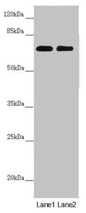 Western blot | All lanes: DYNC1I1 antibody at 1.97 μg/ml | Lane 1: Mouse brain tissue | Lane 2: Mouse gonadal tissue | Secondary | Goat polyclonal to rabbit IgG at 1/10000 dilution | Predicted band size: 73, 71, 69, 68 kDa | Observed band size: 73 kDaRabbit anti-Human DYNC1I1 Polyclonal Antibody