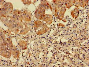 Immunohistochemistry of paraffin-embedded human adrenal gland tissue using RPS5 Antibody at dilution of 1:100Rabbit anti-Human RPS5 Polyclonal Antibody