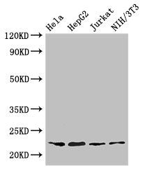 Western Blot  | Positive WB detected in: Hela whole cell lysate, HepG2 whole cell lysate, Jurkat whole cell lysate, NIH/3T3 whole cell lysate  | All lanes: RPS5 antibody at 3.2µg/ml  | Secondary  | Goat polyclonal to rabbit IgG at 1/50000 dilution  | Predicted band size: 23 kDa  | Observed band size: 23 kDaRabbit anti-Human RPS5 Polyclonal Antibody