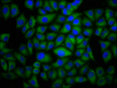 Immunofluorescence staining of Hela cells with DYSF Antibody at 1:100, counter-stained with DAPI. The cells were fixed in 4% formaldehyde, permeabilized using 0.2% Triton X-100 and blocked in 10% normal Goat Serum. The cells were then incubated with the antibody overnight at 4°C. The secondary antibody was Alexa Fluor 488-congugated AffiniPure Goat Anti-Rabbit IgG(H+L).Rabbit anti-Human DYSF Polyclonal Antibody