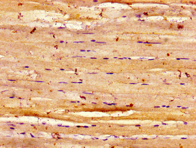 Immunohistochemistry of paraffin-embedded human skeletal muscle tissue using the antibody at dilution of 1:100Rabbit anti-Human DYSF Polyclonal Antibody
