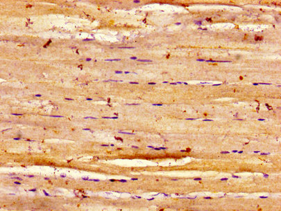Immunohistochemistry of paraffin-embedded human skeletal muscle tissue using the antibody at dilution of 1:100Rabbit anti-Human DYSF Polyclonal Antibody