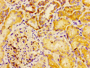 Immunohistochemistry of paraffin-embedded human kidney tissue using DYSF Antibody at dilution of 1:100Rabbit anti-Human DYSF Polyclonal Antibody