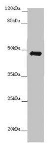 Western blot  | All lanes: E2F1 antibody at 7 μg/ml + 3T3 whole cell lysate  | Secondary  | Goat polyclonal to rabbit IgG at 1/10000 dilution  | Predicted band size: 47 kDa  | Observed band size: 47 kDaRabbit anti-Human E2F1 Polyclonal Antibody