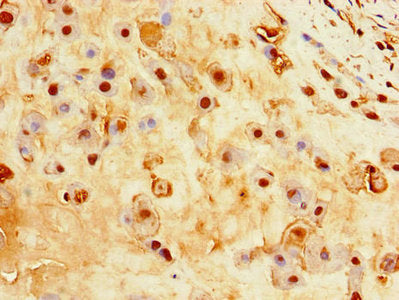 Immunohistochemistry of paraffin-embedded human placenta tissue using EBI3 Antibody at dilution of 1:100Rabbit anti-Human EBI3 Polyclonal Antibody